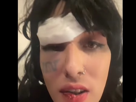 Piriápolis: Custodia policial para la joven trans brutalmente agredida