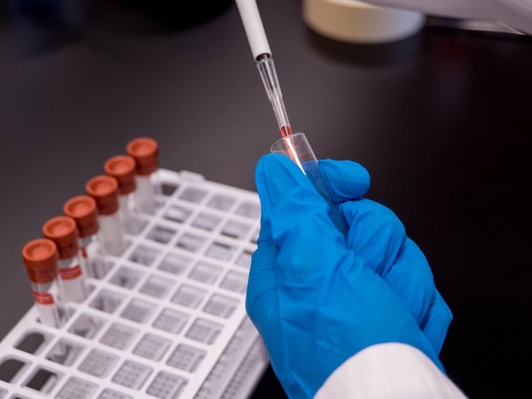 Maldonado se mantiene sin casos autóctonos de dengue y chikungunya
