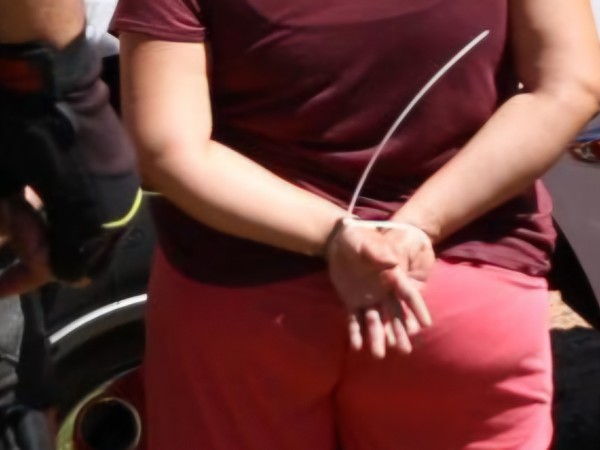 Una mujer con tobill...