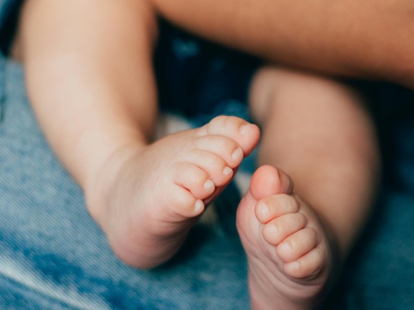 El 20% de niños menores de cinco años tiene dermatitis atópica
