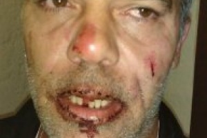 Técnico de Rocha F.C. agredió a periodista deportivo y fue procesado sin prisión