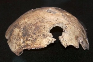 Forense estudia restos óseos encontrados en San Carlos