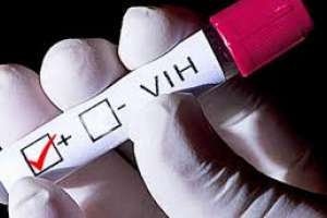 El VIH SIDA es hoy una enfermedad "absolutamente previsible"