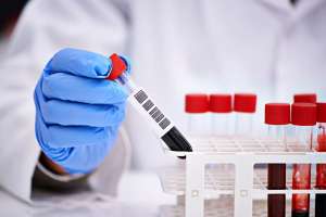 Aumentan cupos para el curso de Técnico en Hemoterapia en el CURE