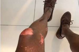 Maldonado: Bomberos denuncian lesiones tras orden de trabajar en construcción de una planchada