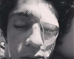 Joven cordobés agredido con un botellazo en Punta del Este se recupera lentamente