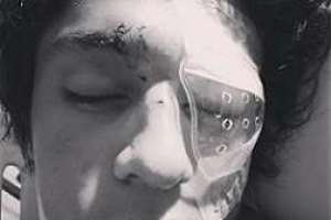 Abogados alcanzaron acuerdo reparatorio en caso de agresión a joven cordobés