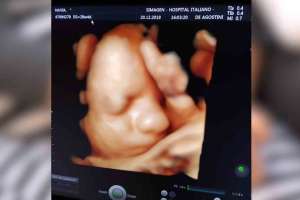 Punta del Este: recaudan fondos para bebé que debe nacer en EE.UU para ser operado de una cardiopatía