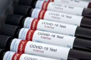 Se registraron 14 casos nuevos de coronavirus y una mujer es la quinta víctima en Uruguay