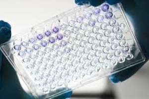 Otro día de cero casos nuevos de Covid-19 en el país