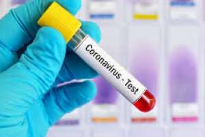 Tres casos nuevos en Treinta y Tres y uno en Montevideo marcan las cifras de martes en materia de Covid-19 en el país