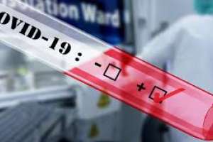 Se registraron 9 casos nuevos de Covid-19 en el país, uno de ellos en Maldonado