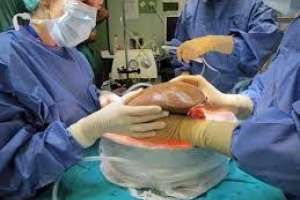 Nueva Semana del Hígado ofrecerá conferencias vía Zoom y resaltará el rol de la prevención