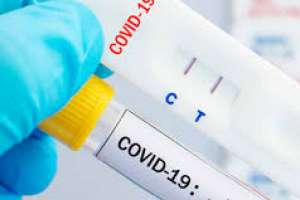 Covid-19: 3.942 casos nuevos, 44 muertos con 1 de Maldonado y 523 personas en CTI