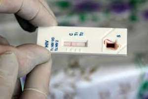 Harán testeos rápidos de VIH en policlínica Vigía