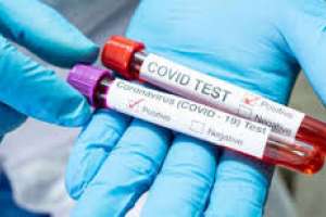 4 muertos por Covid-19 y 169 casos nuevos; Maldonado 27 infectados más