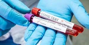 192 casos nuevos, 2 fallecidos, uno en Maldonado y 19 personas en el CTI