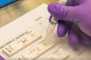 4 farmacias del departamento pueden realizar test rápido de antígeno