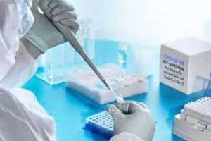 17 fallecimientos y 3.396 casos nuevos de Covid-19; Maldonado tuvo 218 infectados más