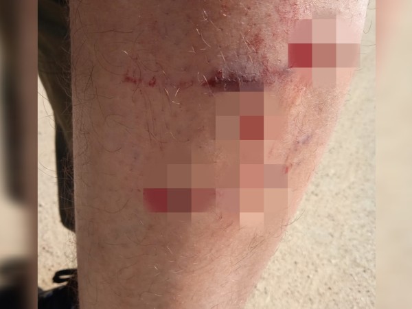 Delivery fue atacado por perros en Maldonado