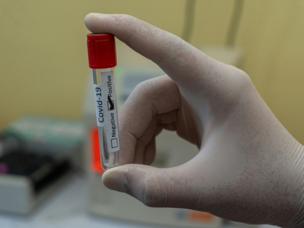 COVID-19: se confirmó la circulación de las variantes Frankenstein y Nimbus en Uruguay